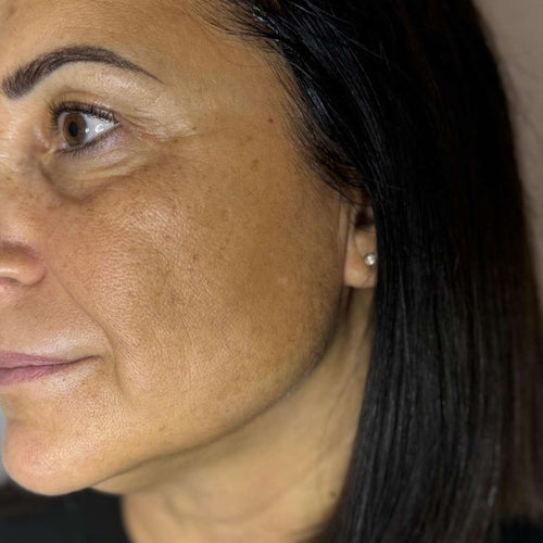 Perché una skincare routine personalizzata è la chiave per avere risultati