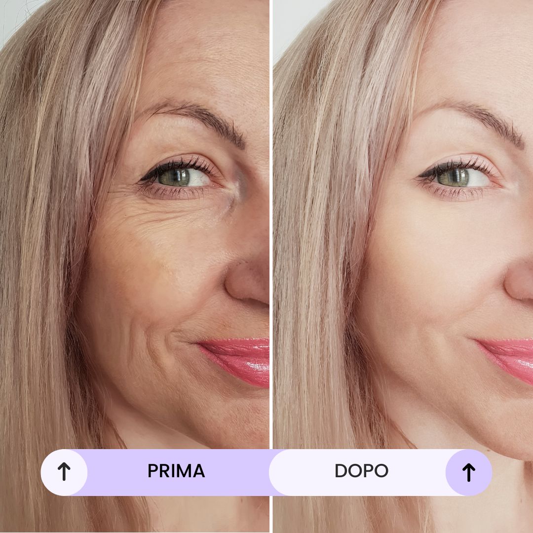 Crema Anti Age Botox - 50 ml