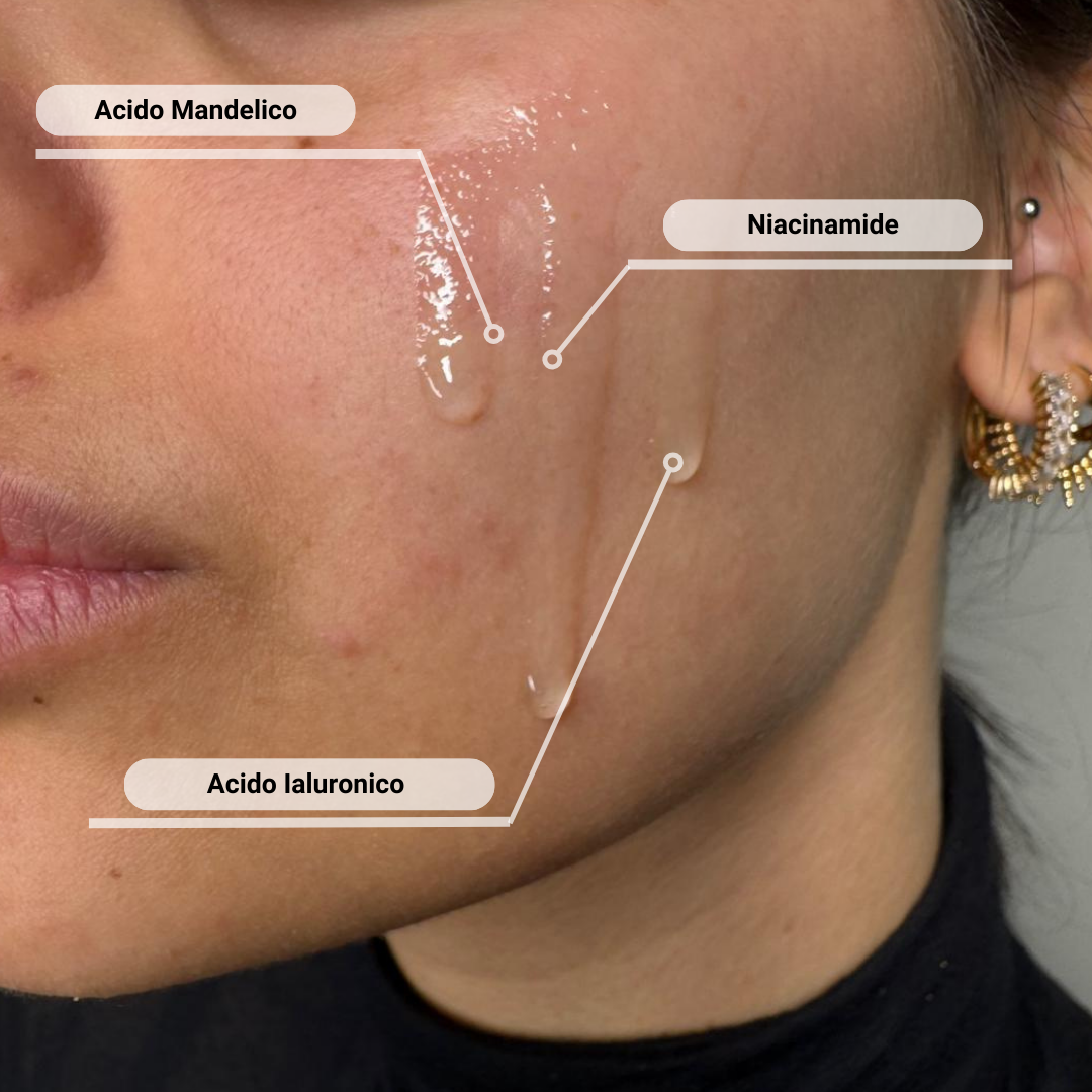 Peeling Mandelico - 20 ml